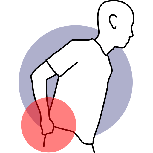 Sciatica